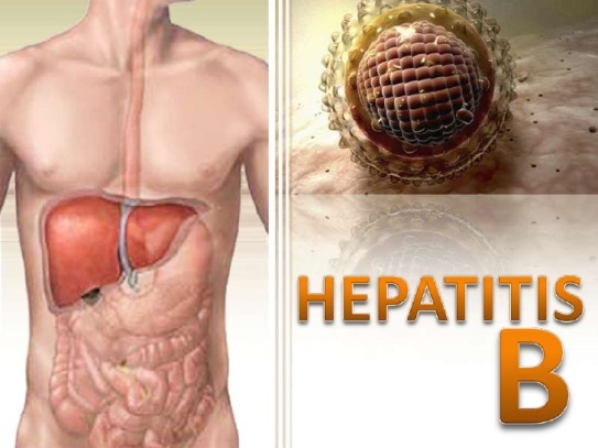 hepatitis-b-1-728